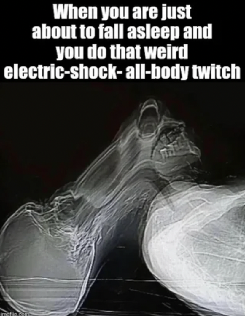 computed tomography - When you are just about to fall asleep and you do that weird electricshockallbody twitch