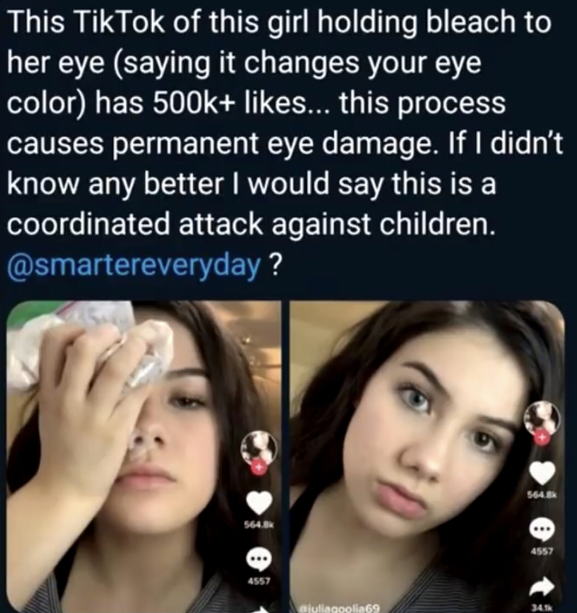 Eye - This Tik Tok of this girl holding bleach to her eye saying it changes your eye color has ... this process causes permanent eye damage. If I didn't know any better I would say this is a coordinated attack against children. ? 564.8 564.Bk 4557 4557 34