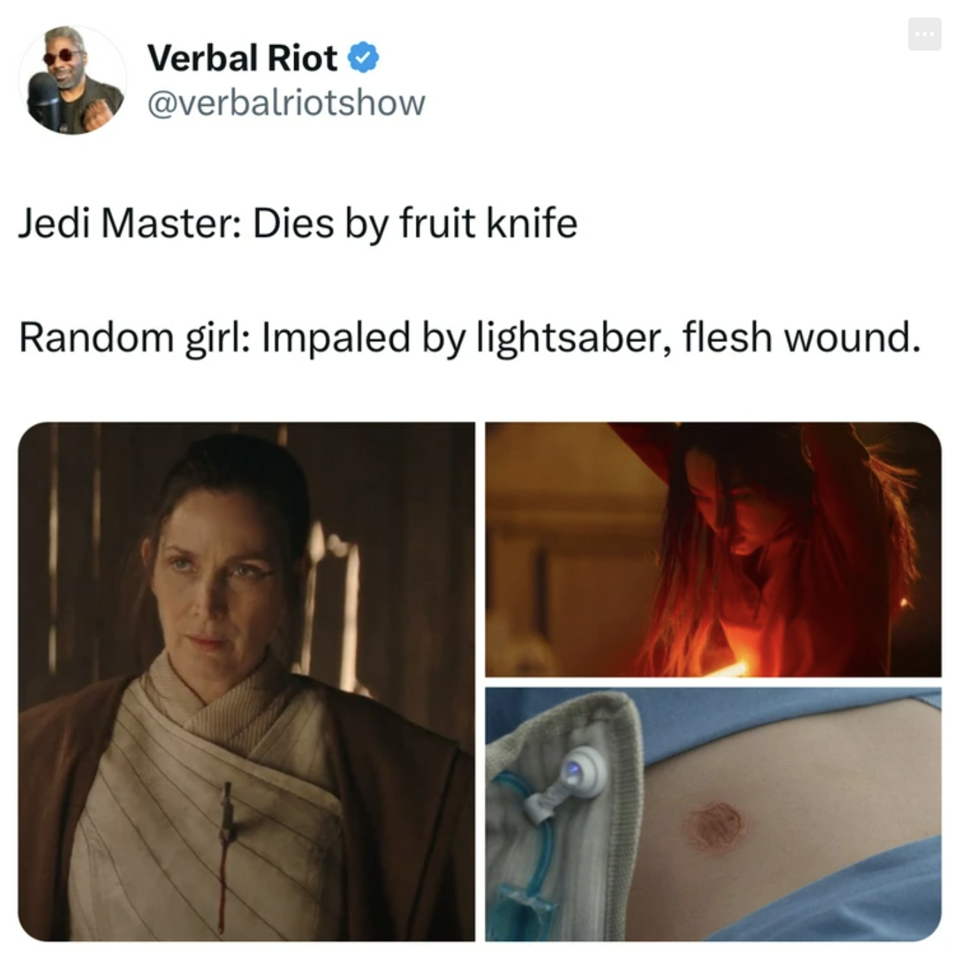 throat - Verbal Riot Jedi Master Dies by fruit knife Random girl Impaled by lightsaber, flesh wound.