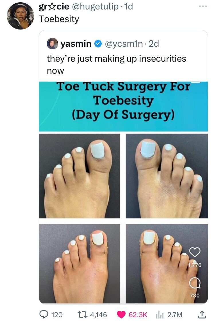 toe - grcie . 1d Toebesity yasmin . 2d they're just making up insecurities now Toe Tuck Surgery For Toebesity Day Of Surgery 120 14,146 2.7M 776 730