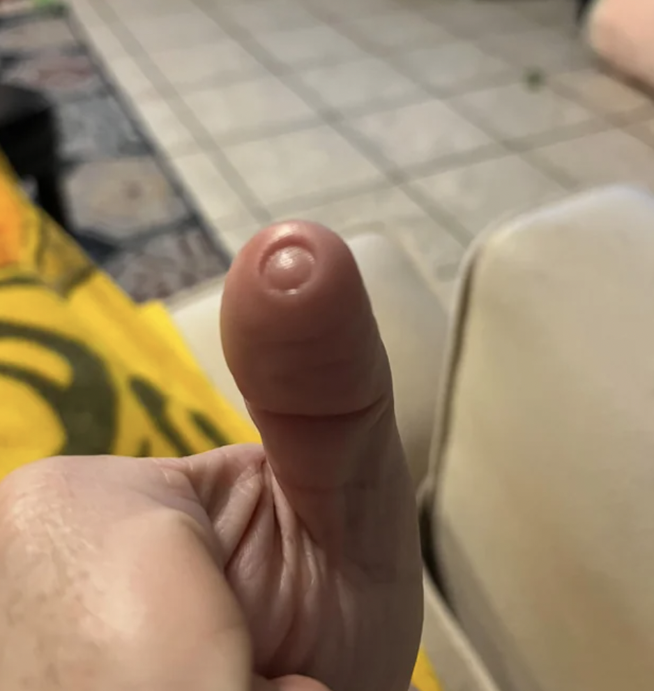 “After many long rounds of Mario Kart my thumb turned into…”