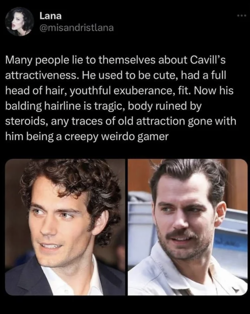 Henry Cavill - Lana Many people lie to themselves about Cavill's attractiveness. He used to be cute, had a full head of hair, youthful exuberance, fit. Now his balding hairline is tragic, body ruined by steroids, any traces of old attraction gone with him