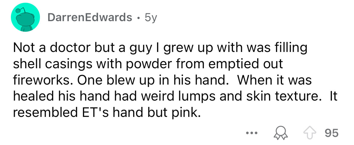 number - DarrenEdwards . 5y Not a doctor but a guy I grew up with was filling shell casings with powder from emptied out fireworks. One blew up in his hand. When it was healed his hand had weird lumps and skin texture. It resembled Et's hand but pink. 95