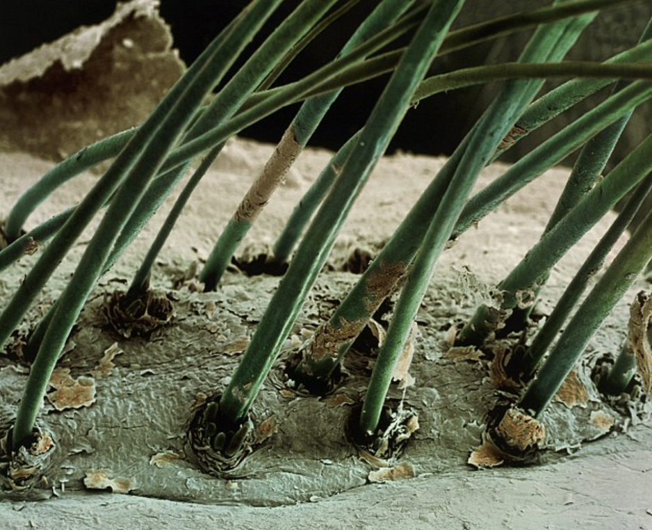 electron microscope eyelash