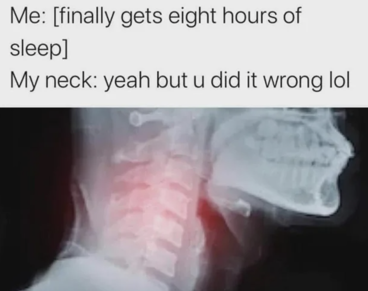 neck yeah but you did it wrong - Me finally gets eight hours of sleep My neck yeah but u did it wrong lol 77777