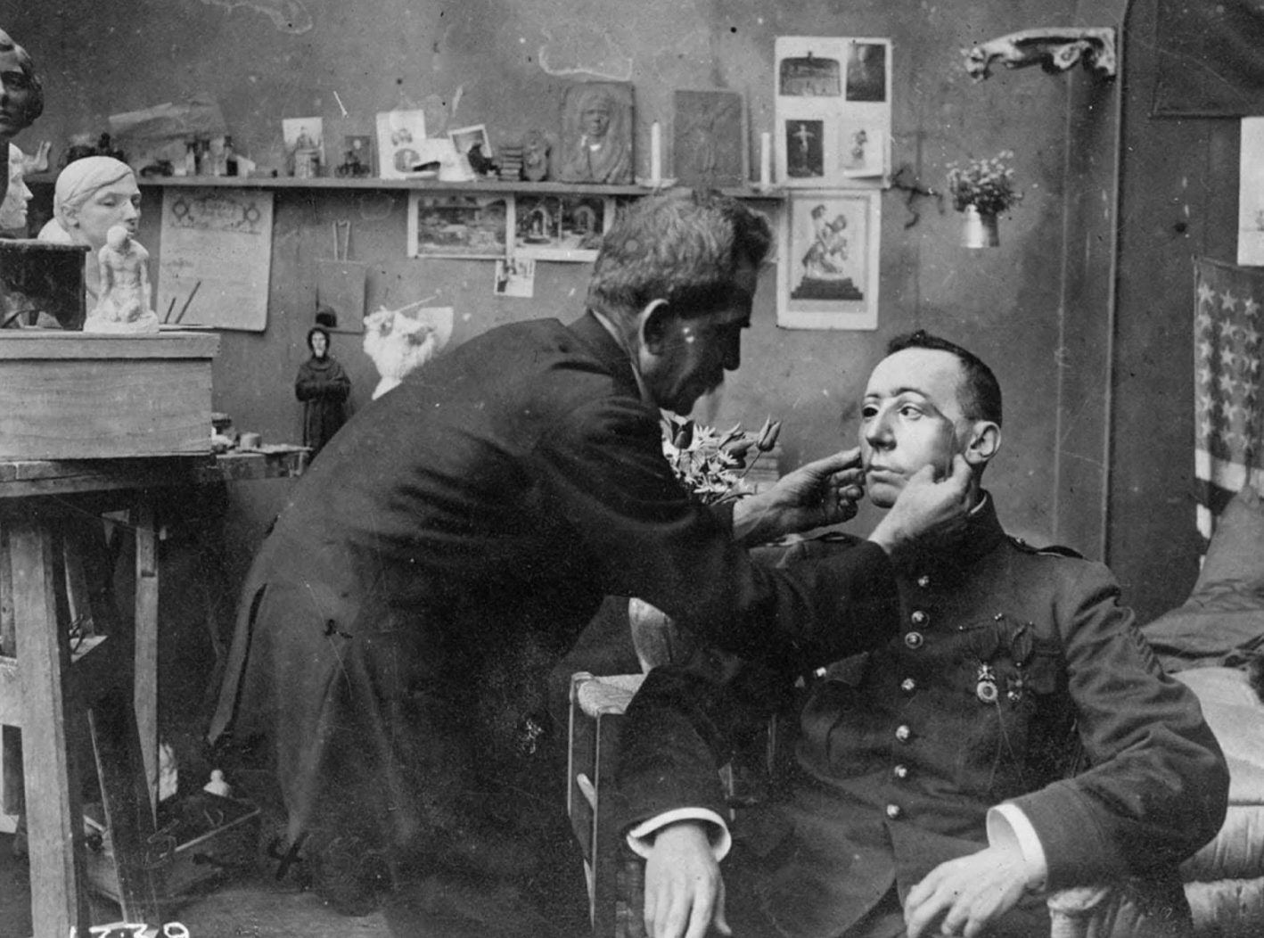 17 Harrowing WWI Soldier Being Fitted For Prosthetic Masks 