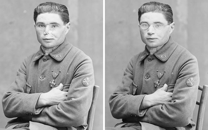 17 Harrowing WWI Soldier Being Fitted For Prosthetic Masks 