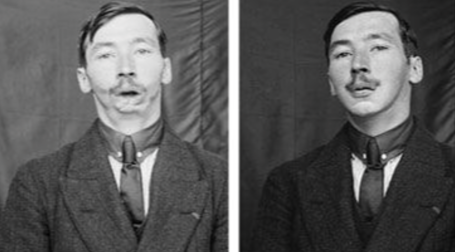 17 Harrowing WWI Soldier Being Fitted For Prosthetic Masks 