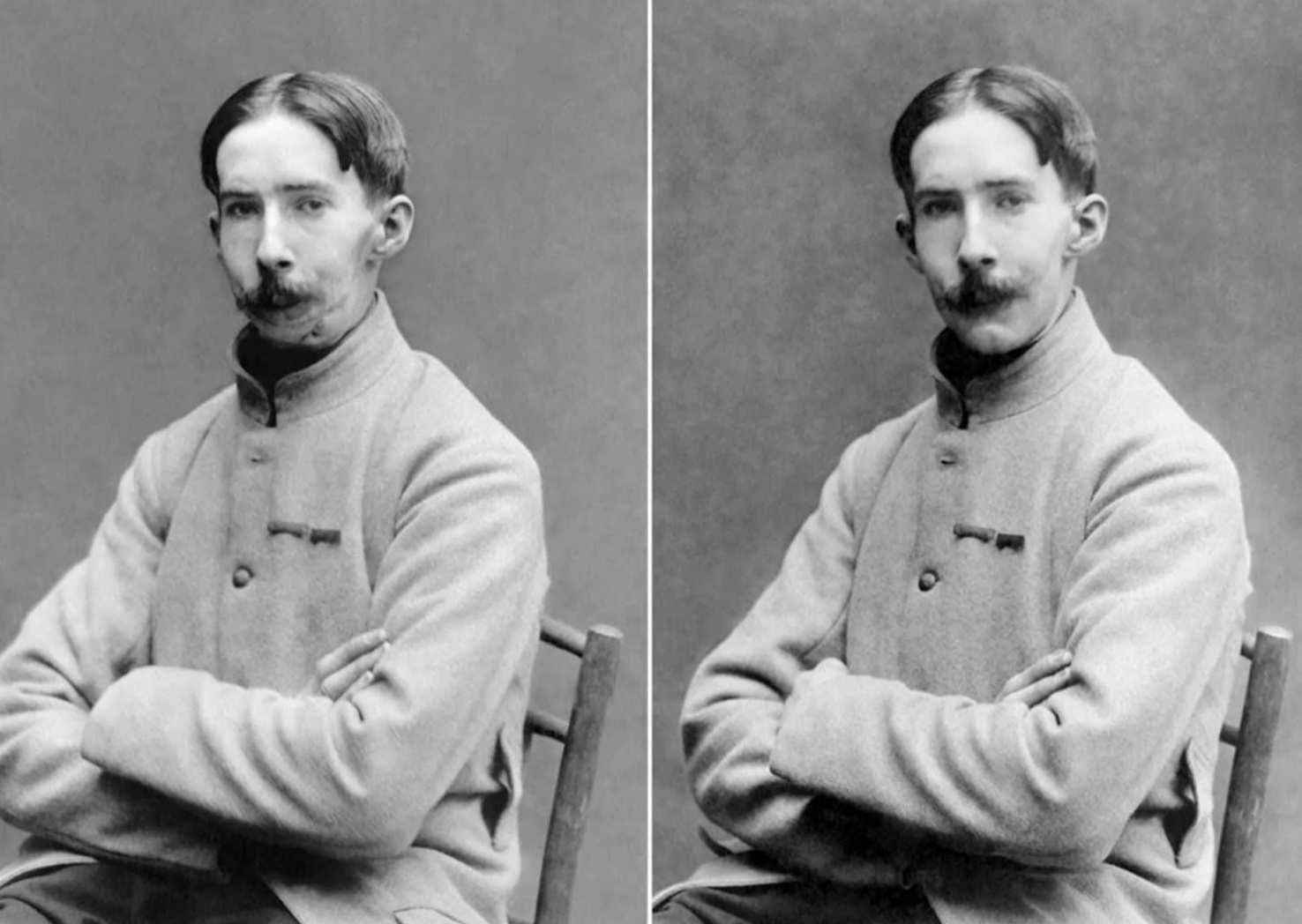 17 Harrowing WWI Soldier Being Fitted For Prosthetic Masks 