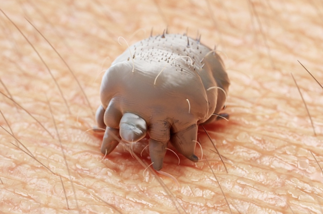 skin mites