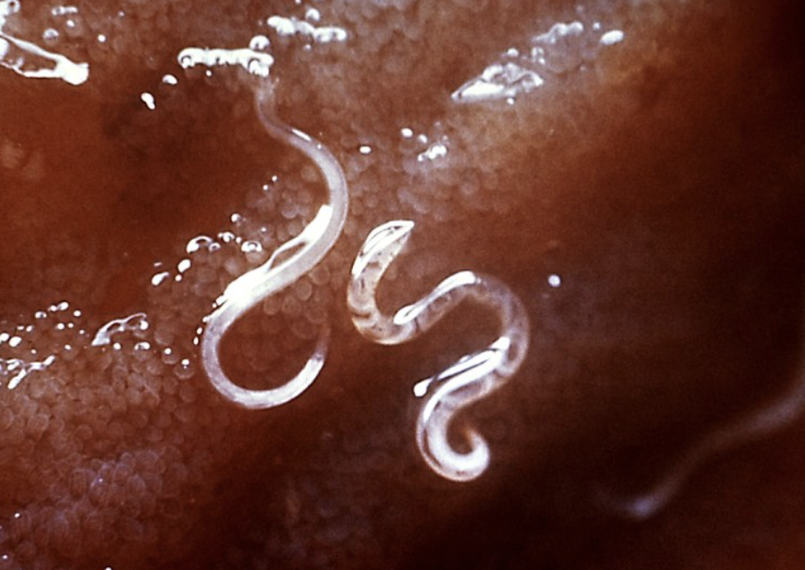 hookworm - V