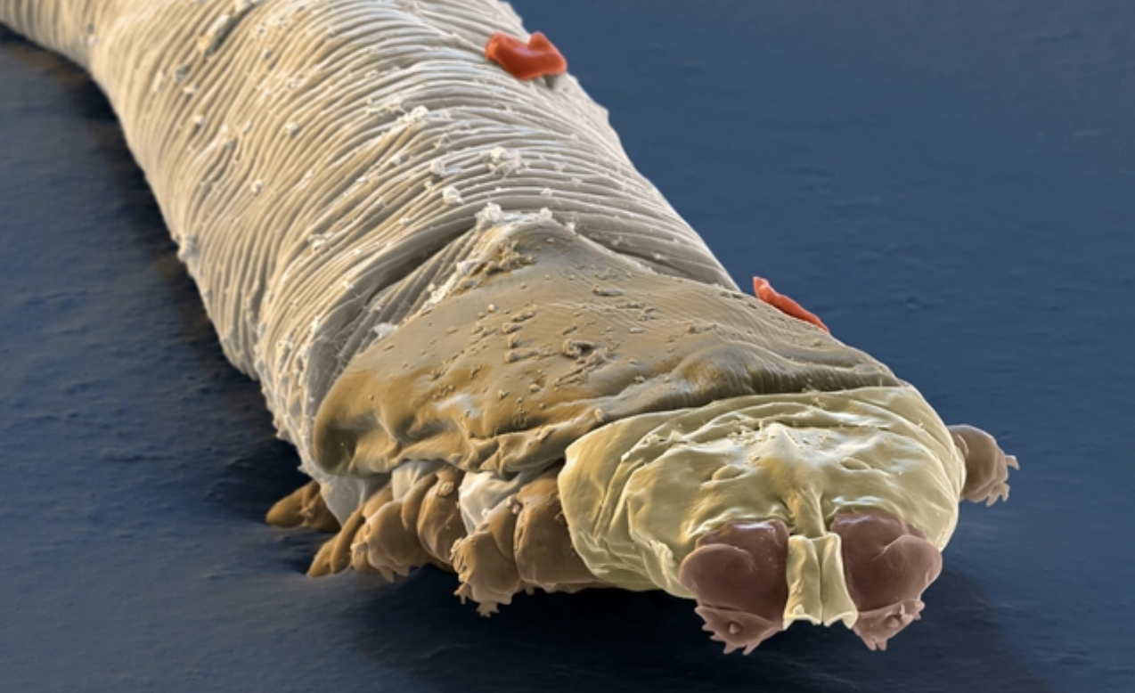 demodex mites treatment uk