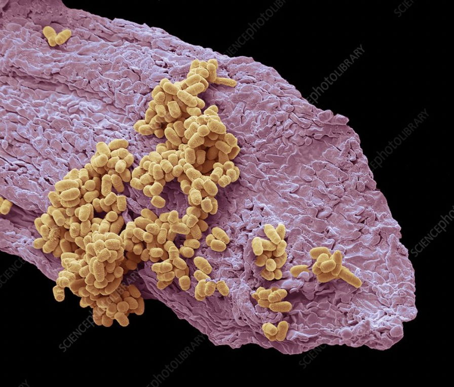 bacteria in the belly button - Cience ENCEphotoLIE Sciencedar photoLIBRARY photoLIBRARY Scie EphotoLIBRARY Scienc Scienceph