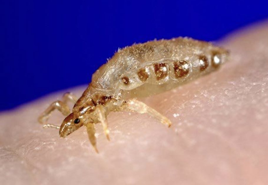 lice on humans