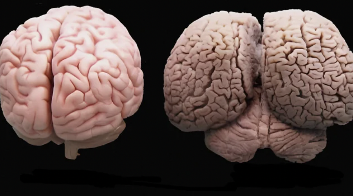 A human brain on the left, a dolphin brain on the right.