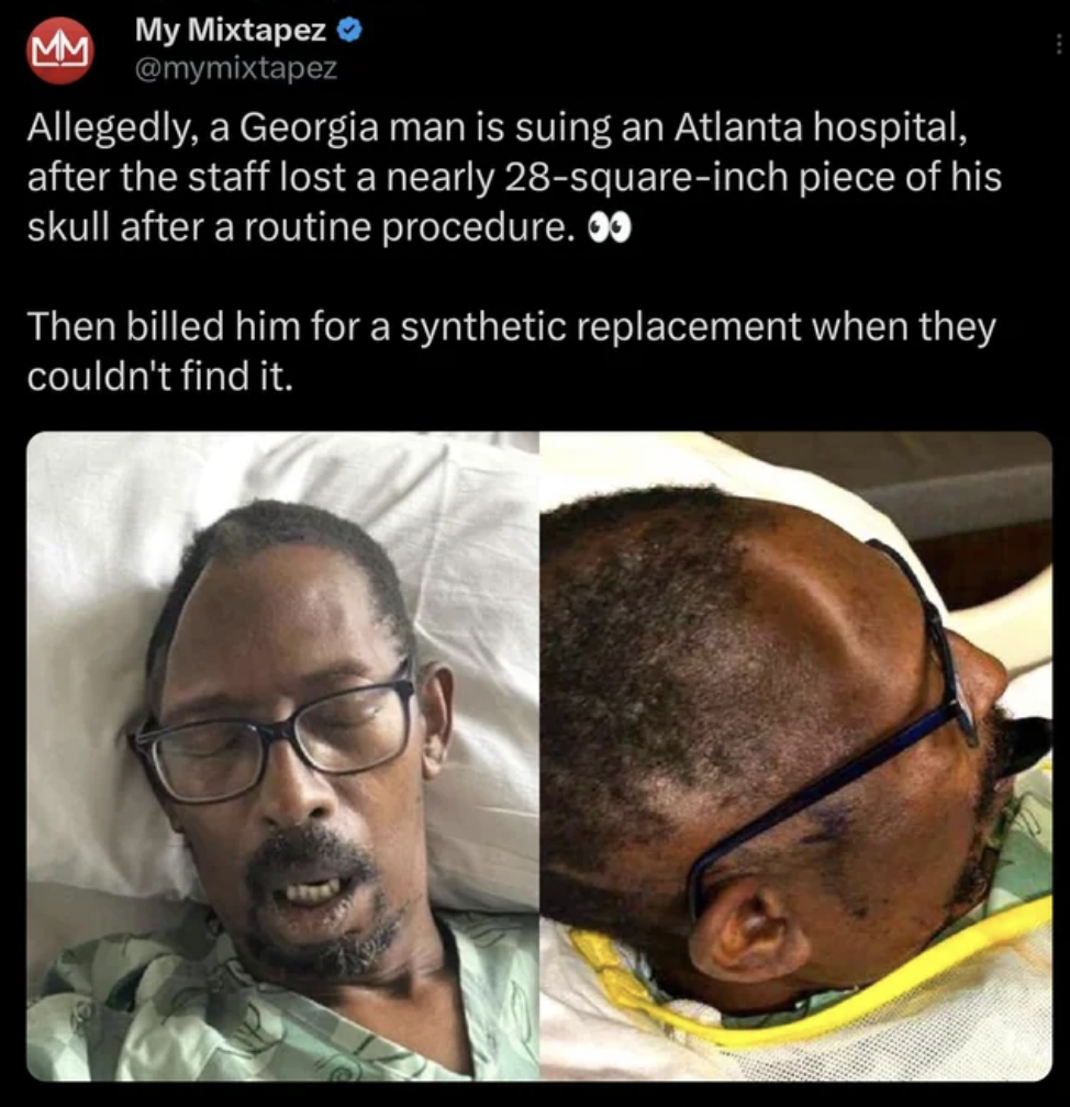 Hospital - My Mixtapez Allegedly, a Georgia man is suing an Atlanta hospital, after the staff lost a nearly 28squareinch piece of his skull after a routine procedure. Then billed him for a synthetic replacement when they couldn't find it.