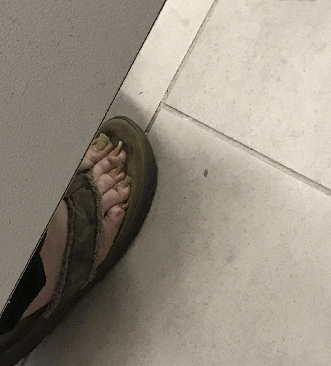 20 Slobs Who Have No Shame About Displaying Their Stinky Feet In Public