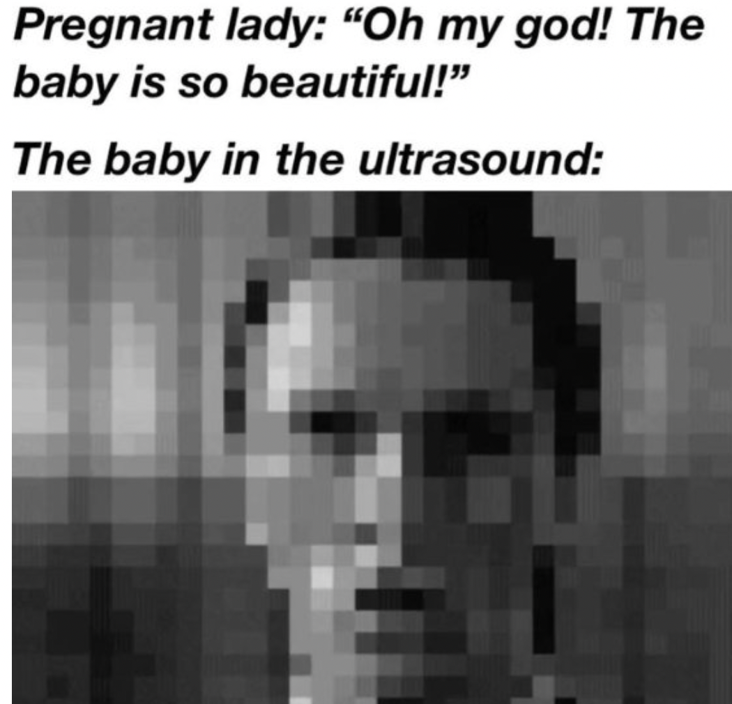 monochrome - Pregnant lady "Oh my god! The baby is so beautiful!" The baby in the ultrasound