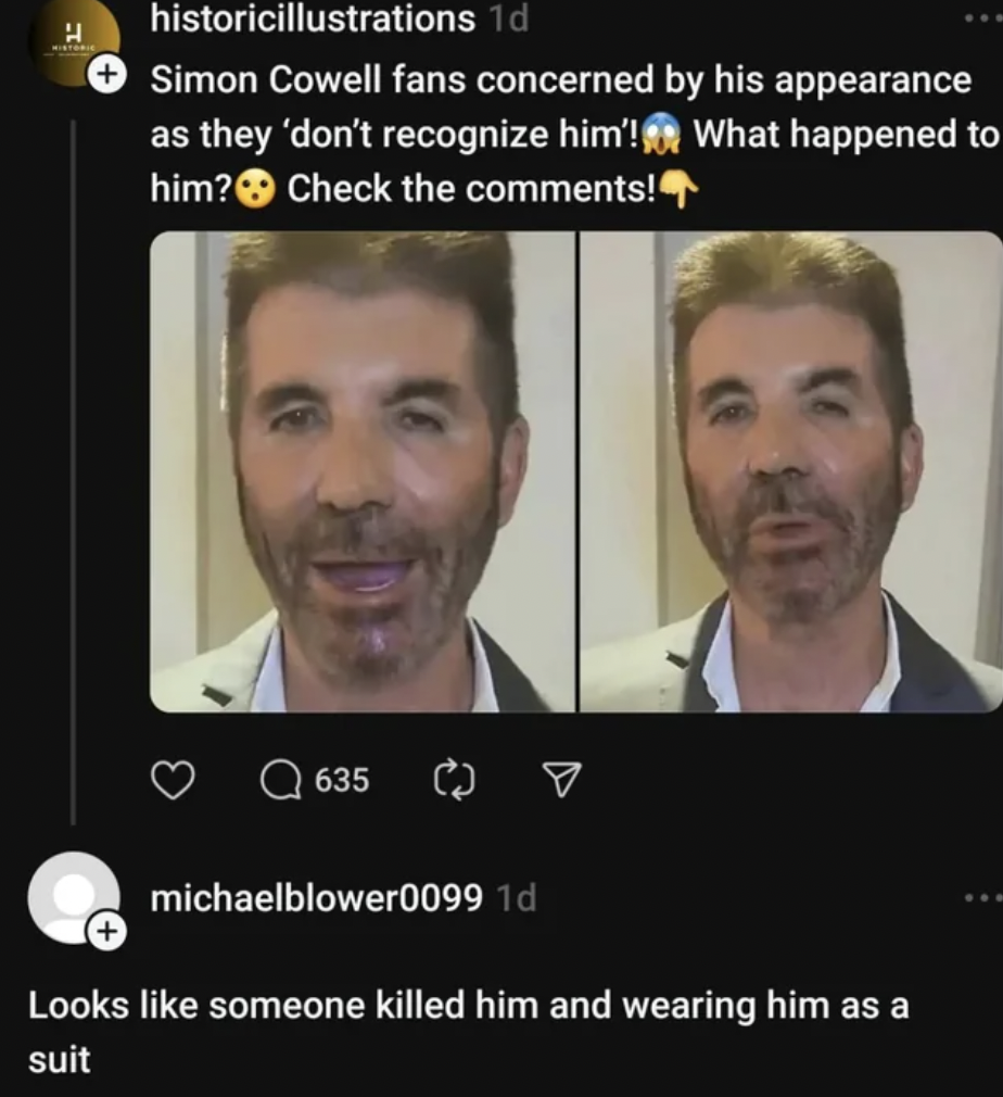 photo caption - historicillustrations 1d Simon Cowell fans concerned by his appearance as they 'don't recognize him'! him? What happened to Check the ! 635 C michaelblower0099 1d Looks someone killed him and wearing him as a suit