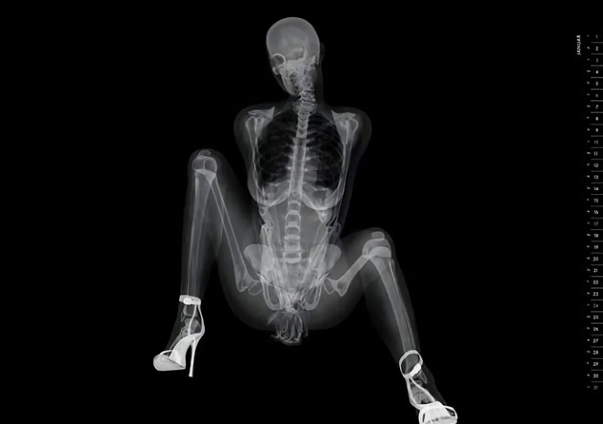 x-ray