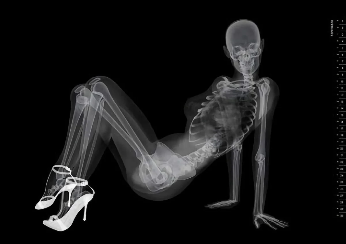 x ray pinup calendar