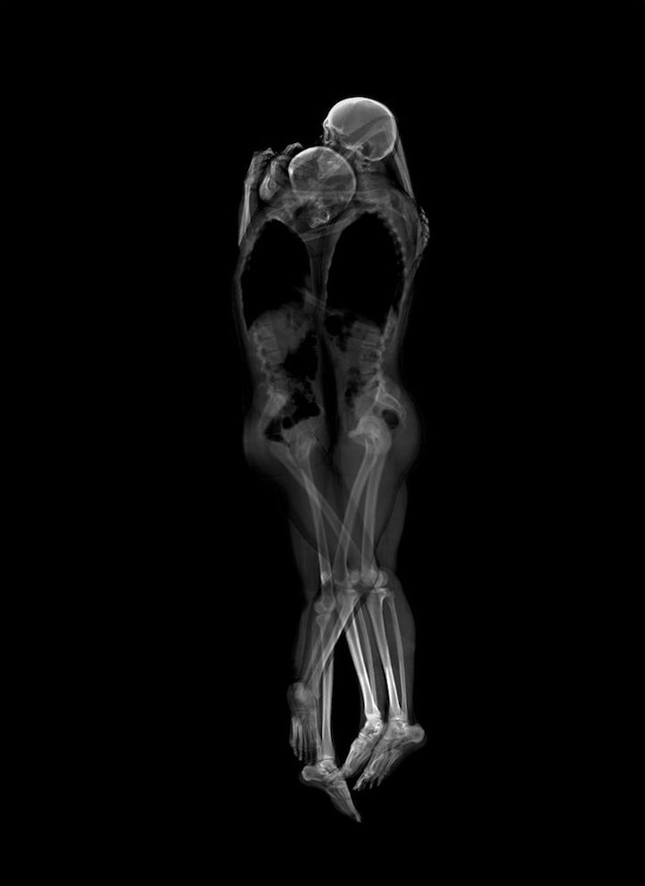 x ray