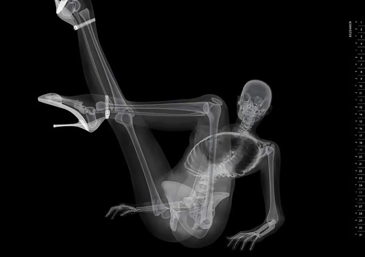 x-ray