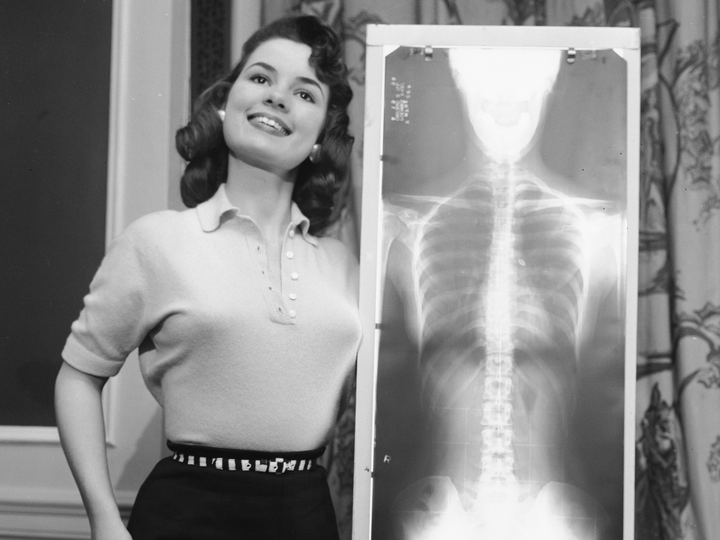 perfect posture x ray - Mocock