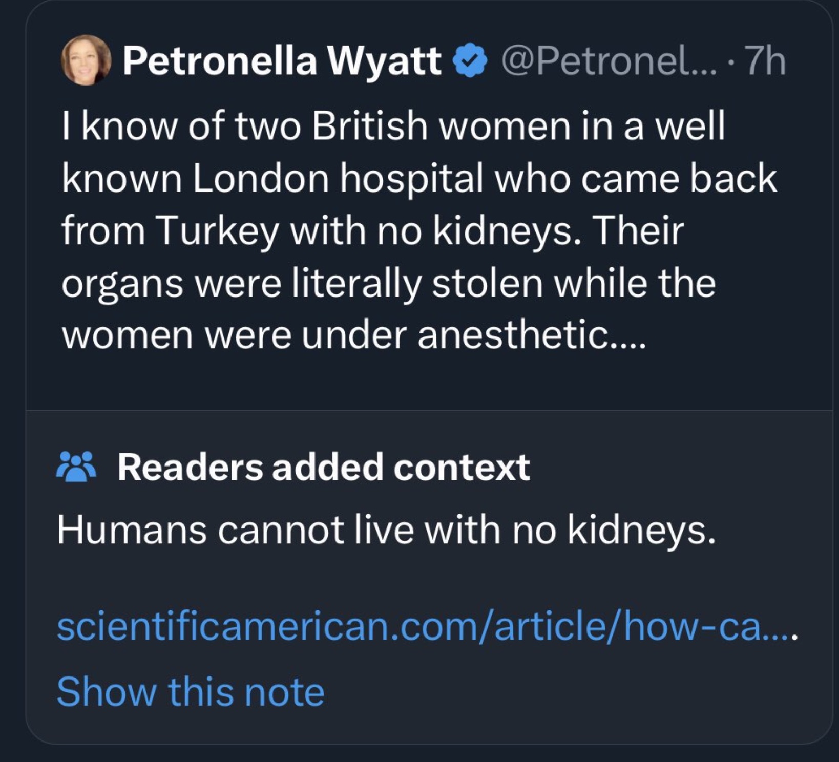 screenshot - Petronella Wyatt ... 7h I know of two British women in a well known London hospital who came back from Turkey with no kidneys. Their organs were literally stolen while the women were under anesthetic.... Readers added context Humans cannot li