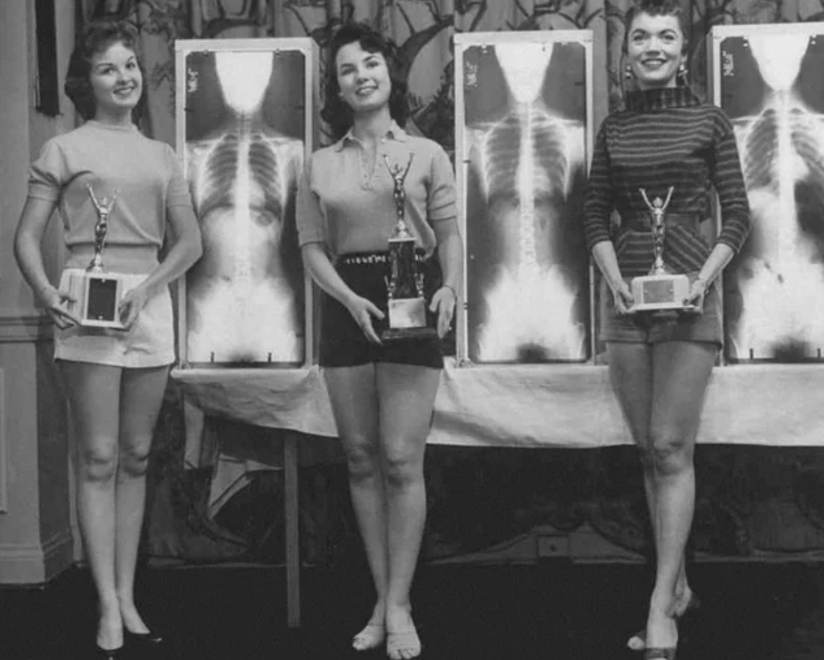 x ray beauty contest