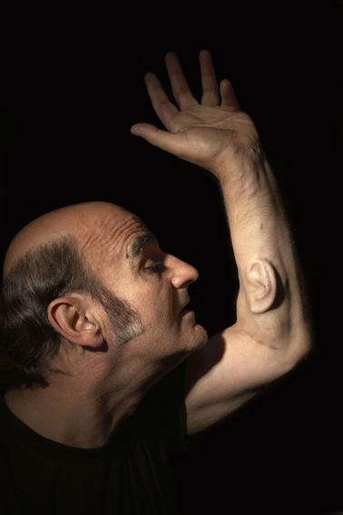 25 Images from Stelarc's Third Ear Experiment