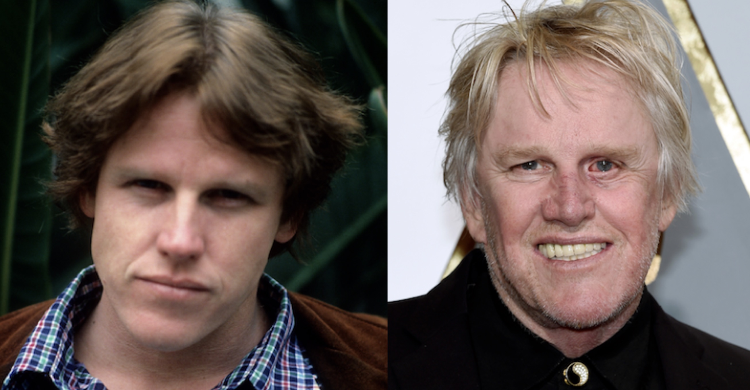 happened to gary busey's face