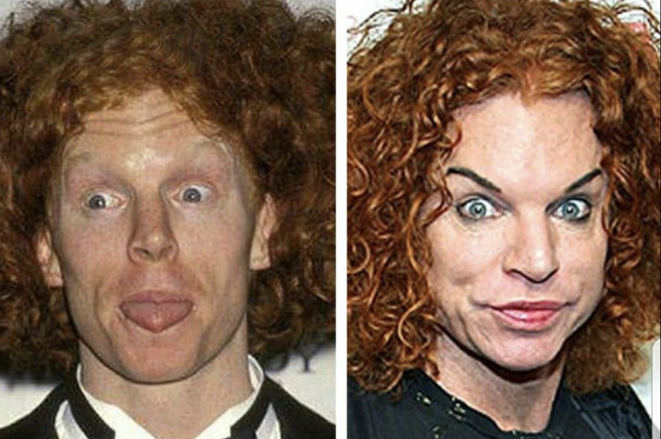 before and after plastic surgery funny