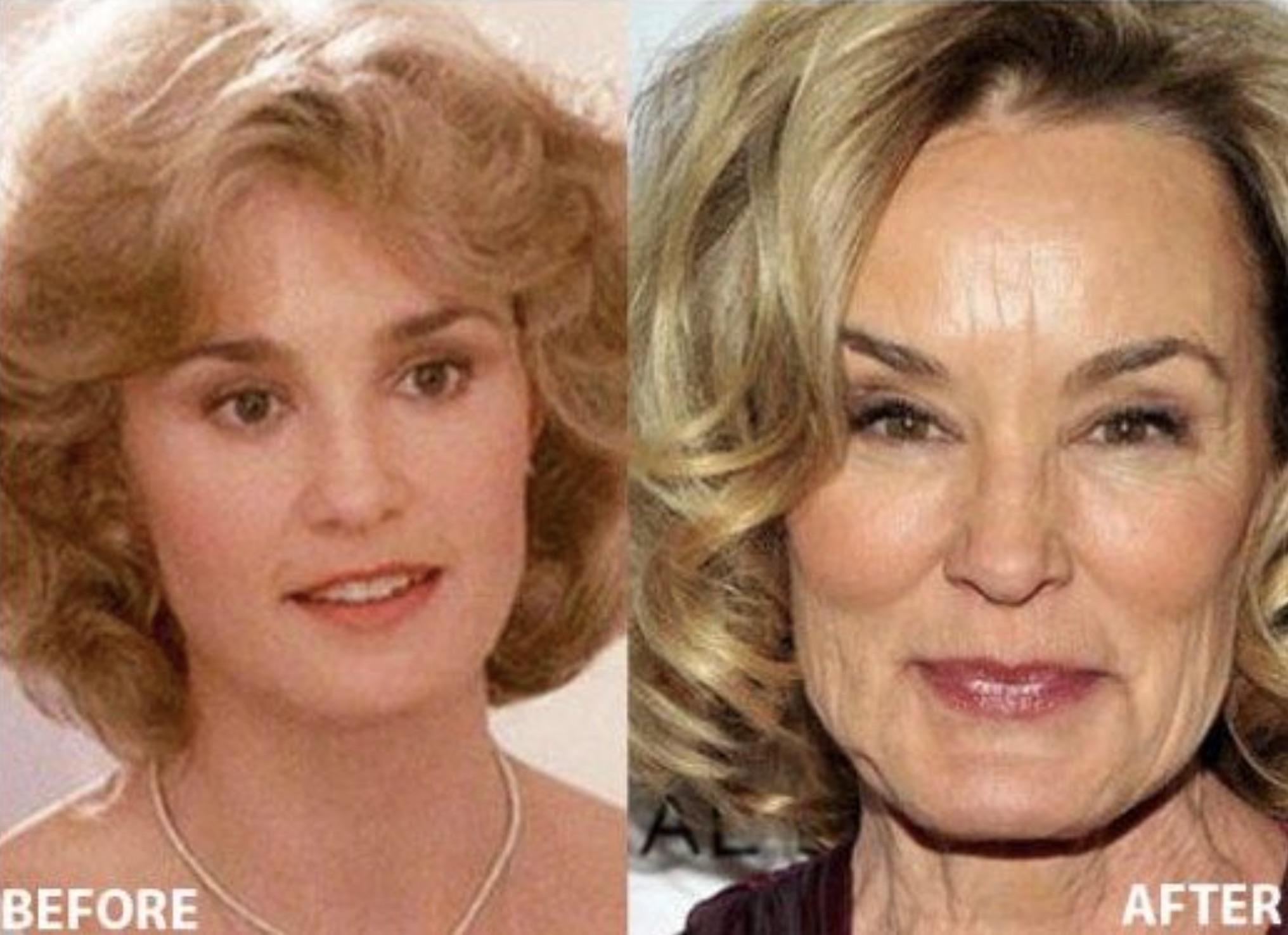 jessica lange plastic surgery - Before After