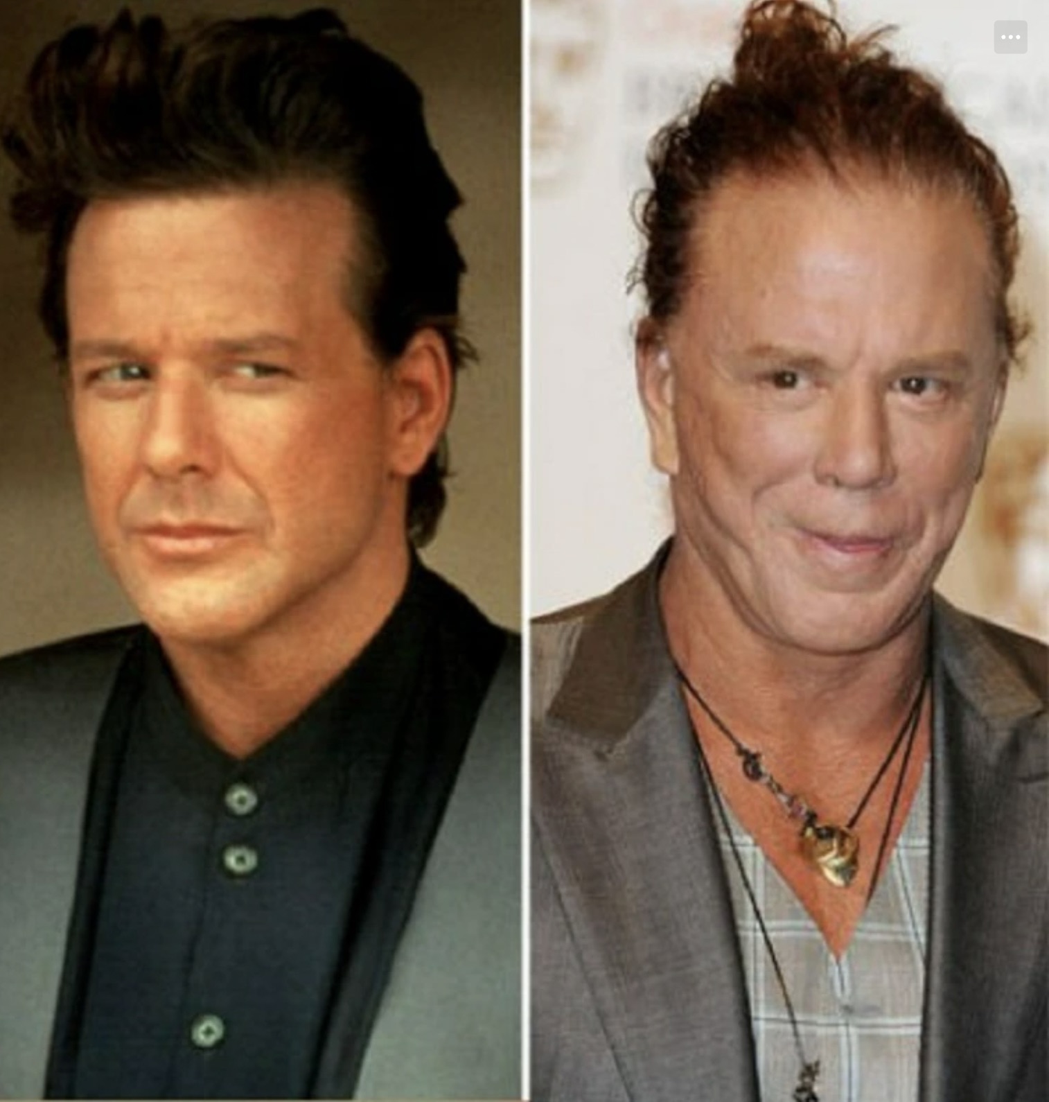 mickey rourke plastic surgery