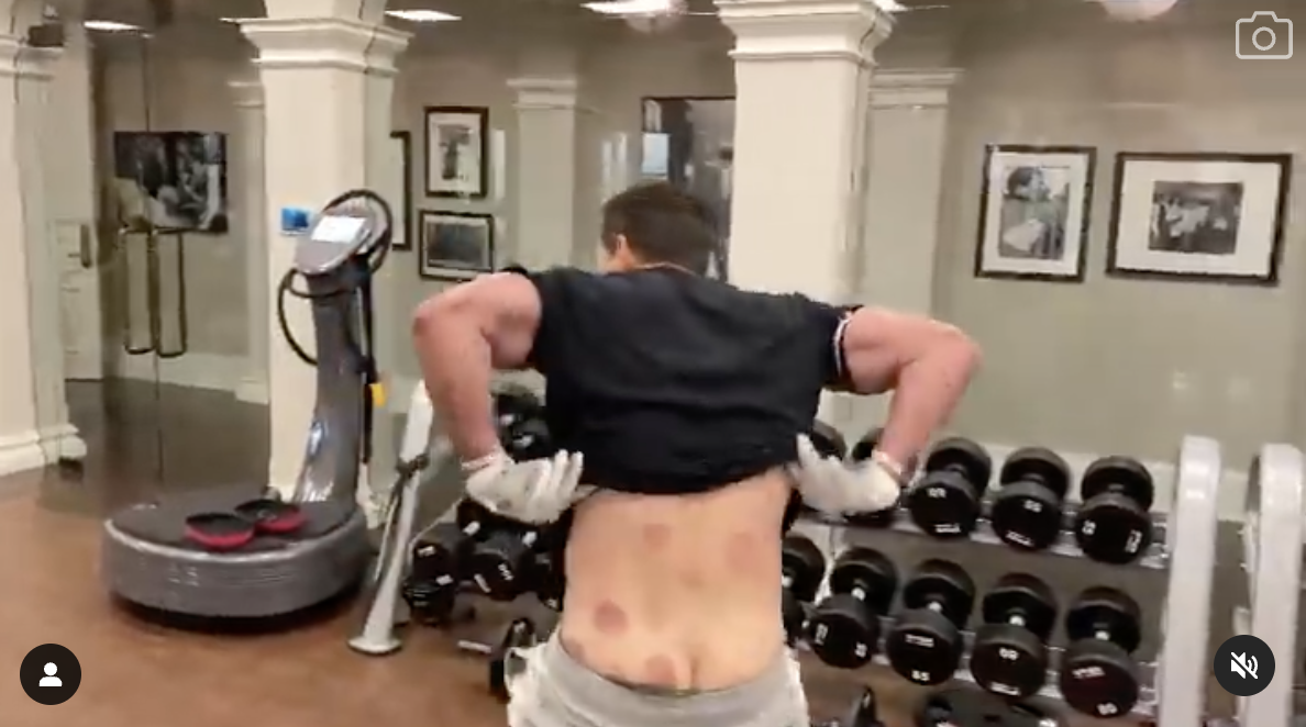 Mark Wahlberg showing off his “cupping” at the gym, along with his crack. 