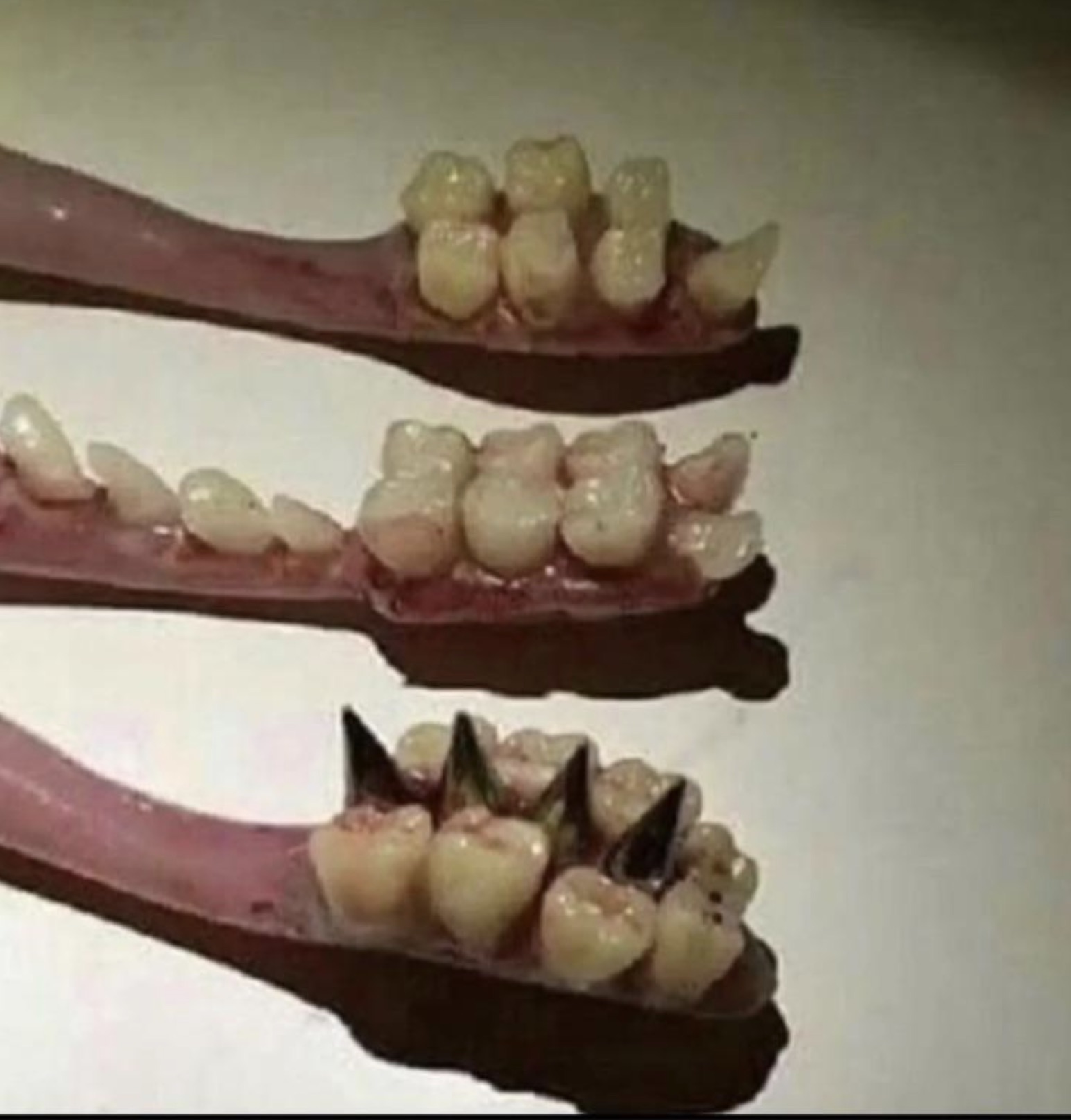 teeth cursed