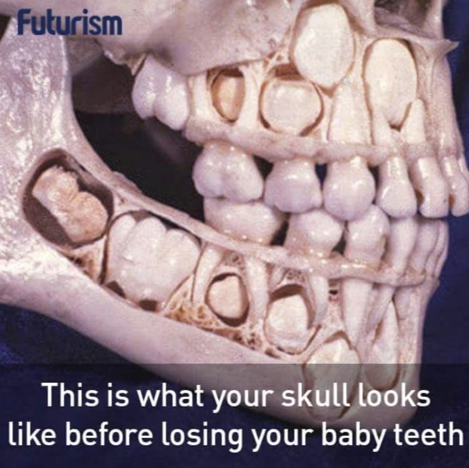 eye trypophobia teeth - Futurism This is what your skull looks before losing your baby teeth