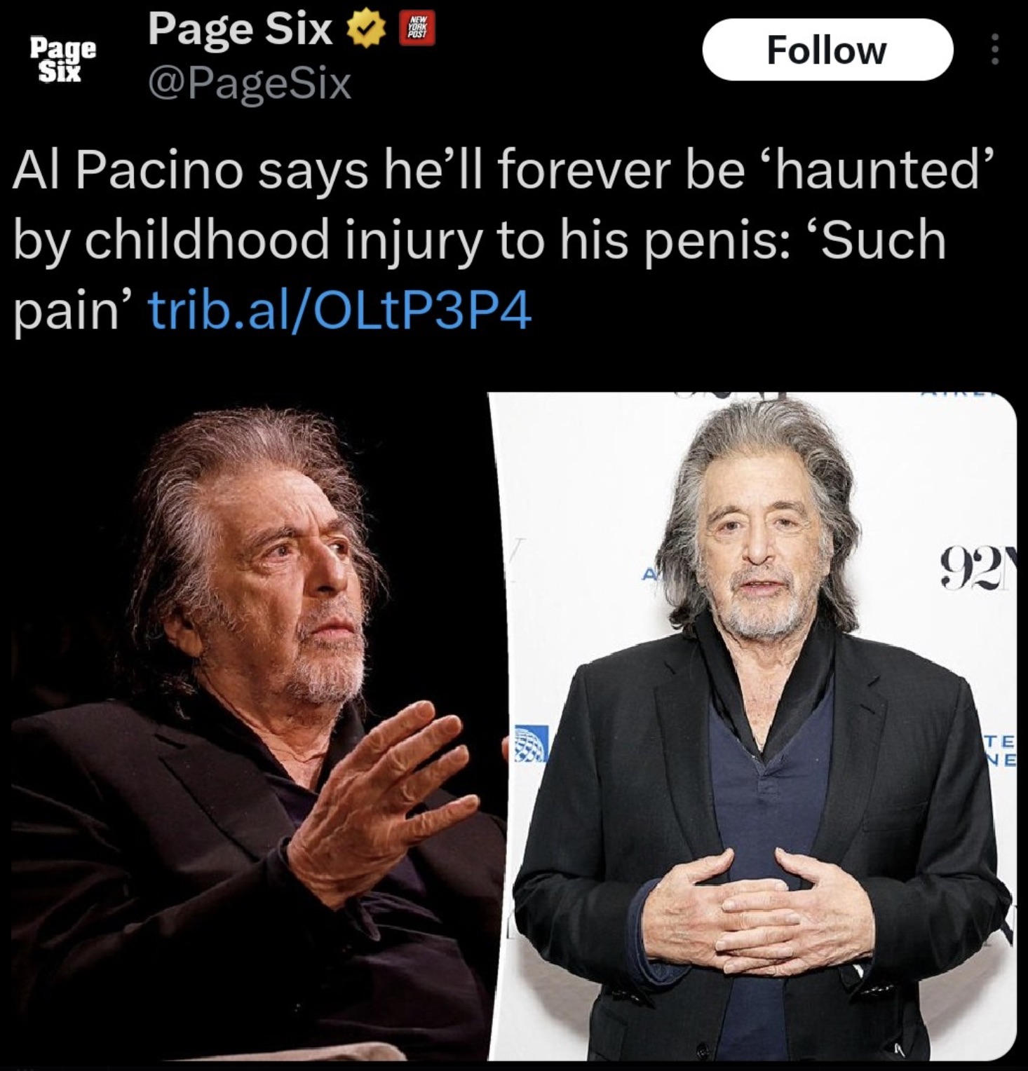 Al Pacino - Page Six Page Six New York Post Al Pacino says he'll forever be 'haunted' by childhood injury to his penis 'Such pain' trib.alOLtP3P4 921 Te Ne