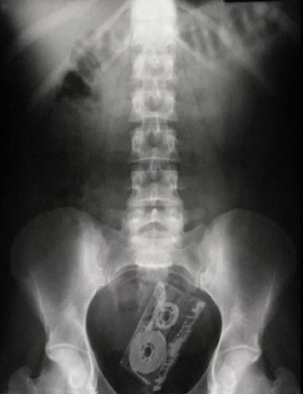 embarrassing x rays -