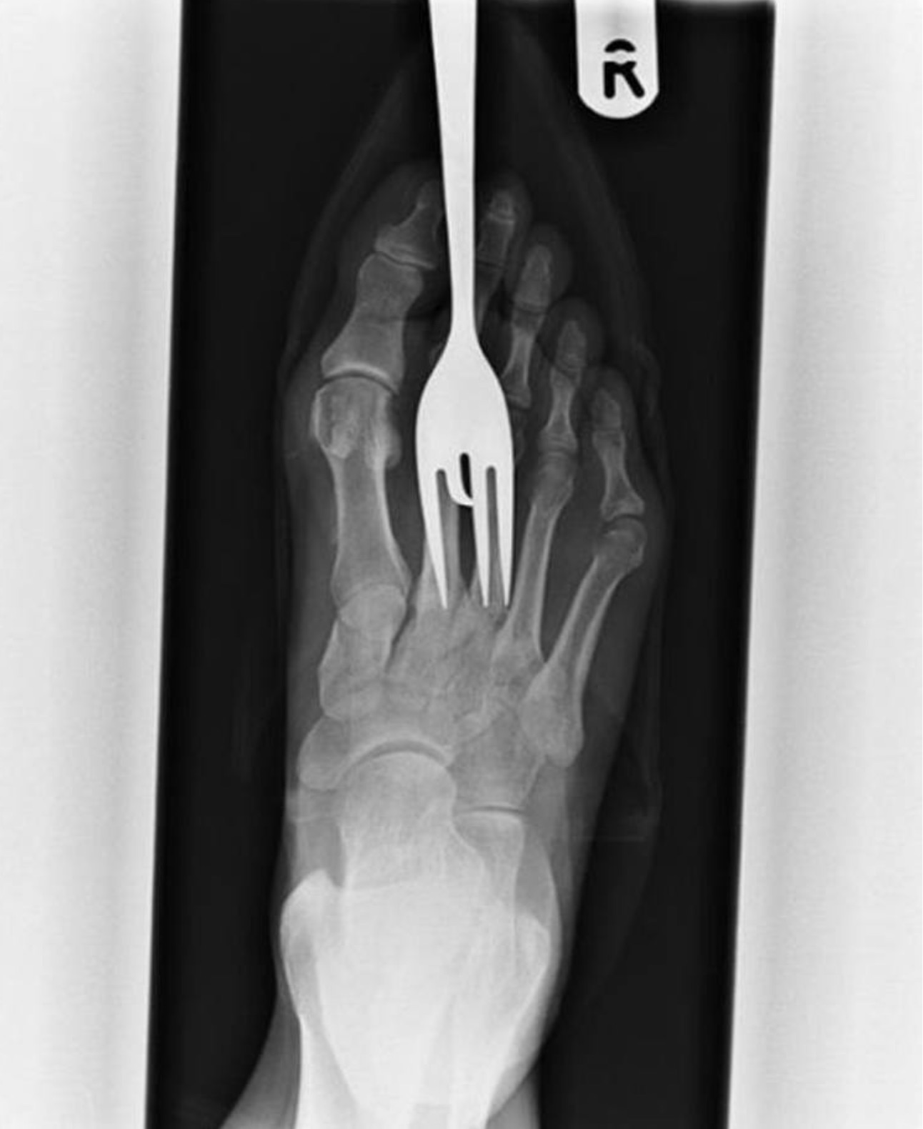 weirdest xrays -