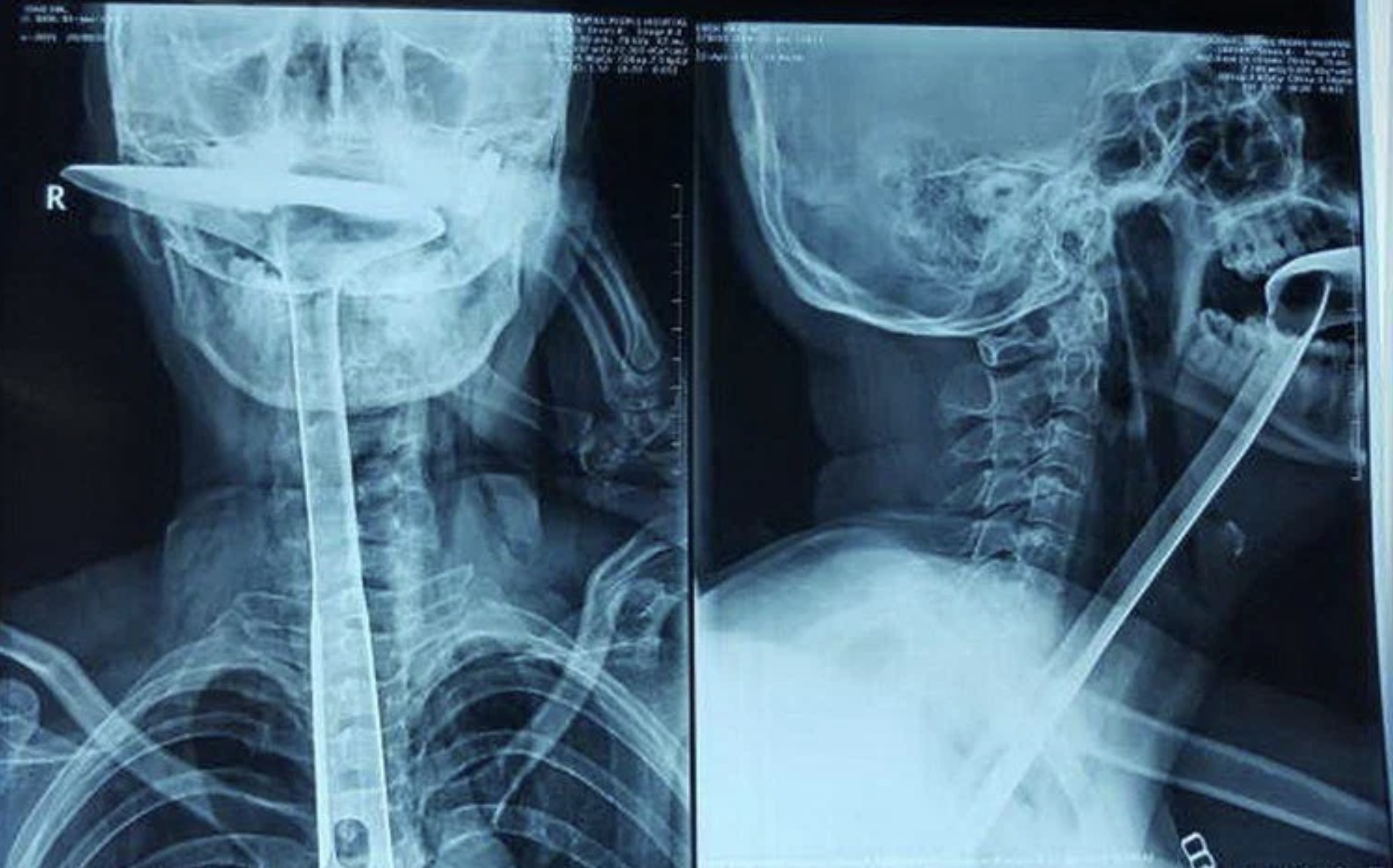 strangest x rays