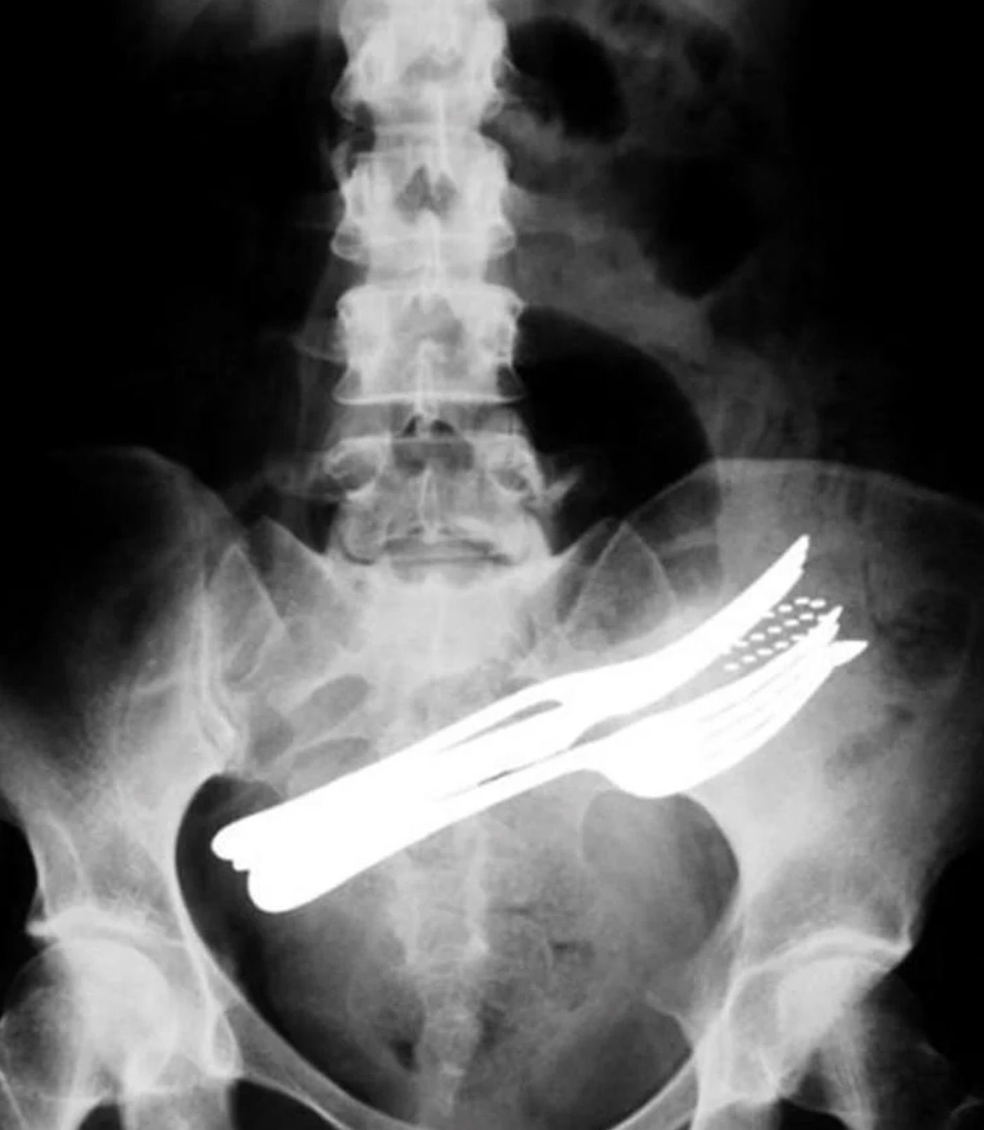 strange x ray