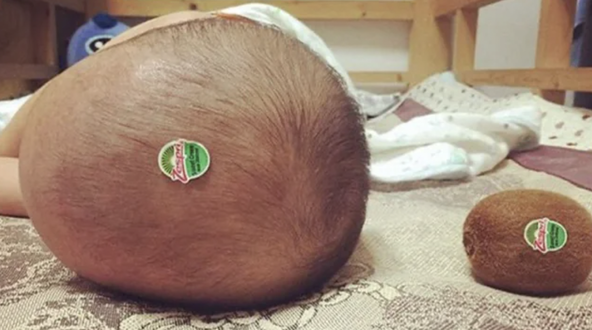 baby kiwi head - D