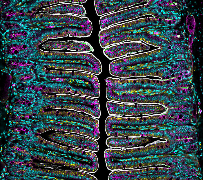 Intestinal villi - Medical University of South Carolina Department of Regenerative Medicine & Cell Biology, Charleston, South Carolina, USA