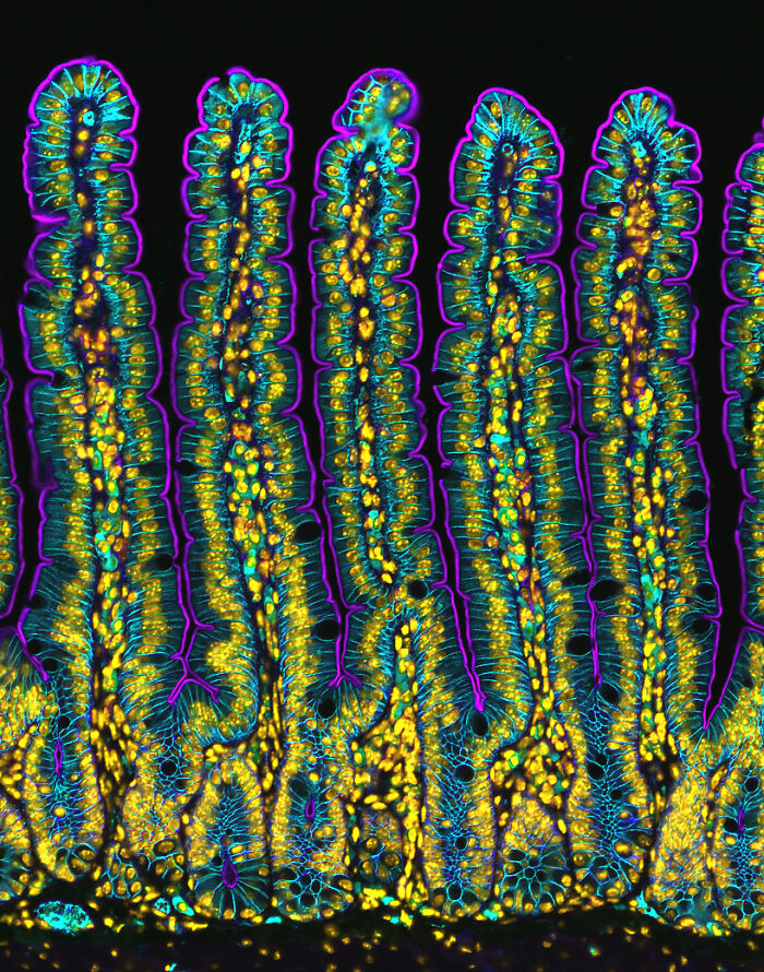 A section of small intestine of a Mouse - Medical University of South Carolina Department of Regenerative Medicine & Cell Biology, Charleston, South Carolina, USA