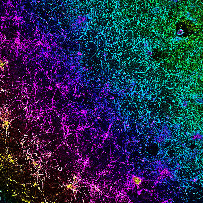 A network of dopaminergic neurons generated from human stem cells - University of Oxford Nuffield Department of Clinical Neurosciences (NDCN) Oxford, Oxfordshire, United Kingdom