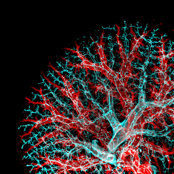 Some Lymphatic vasculature (cyan) and vessels (red) of a mouse lung - University of California, San Francisco Pulmonary, Critical Care, Allergy and Sleep Medicine, San Francisco, California, USA