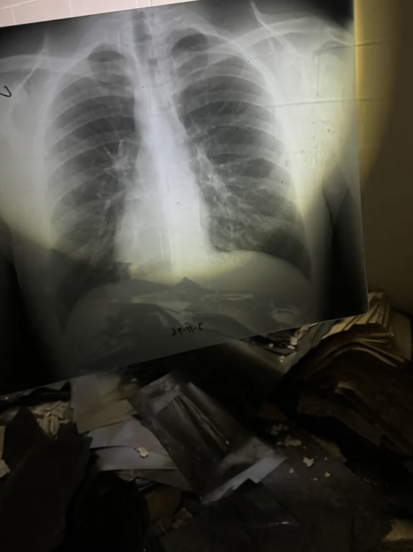 x-ray