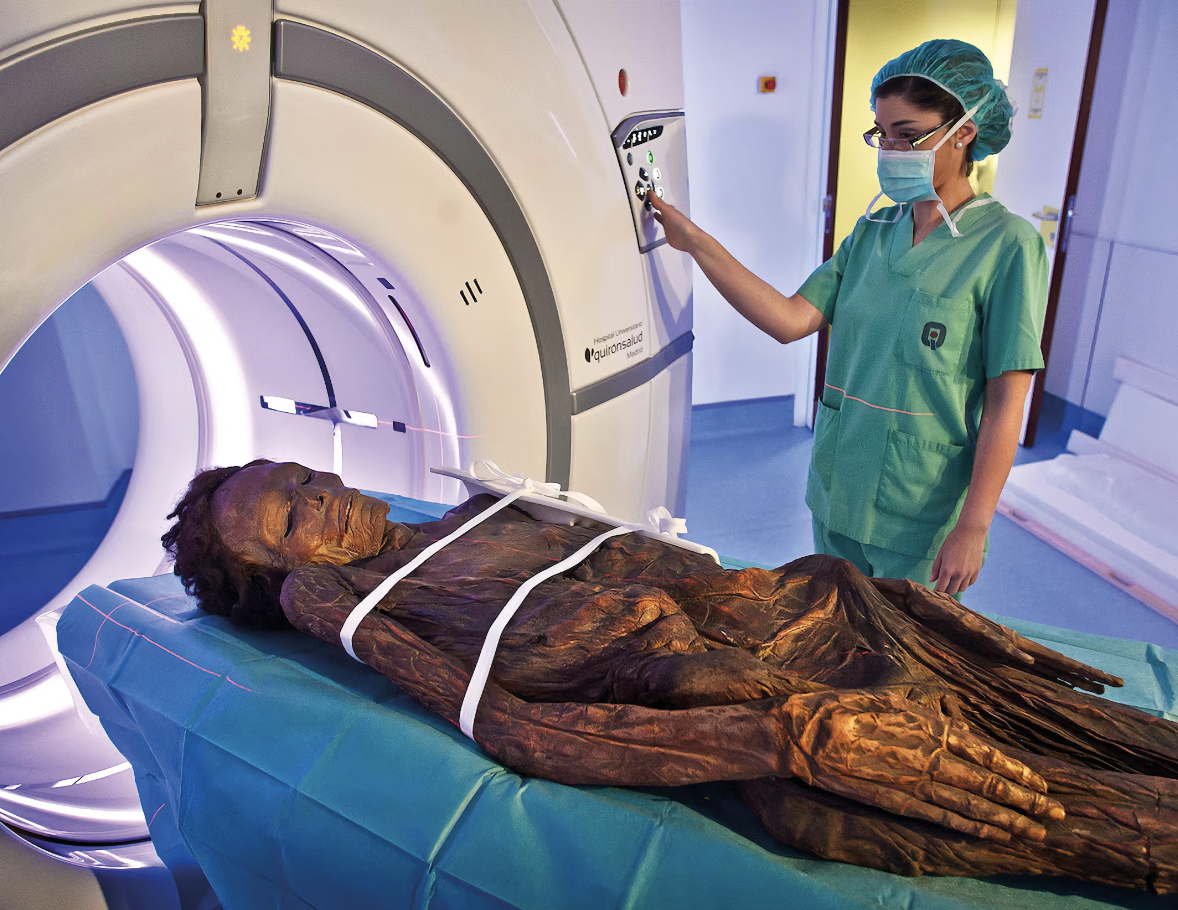 A CT scan performed in 2016 on the best preserved Guanche mummy.